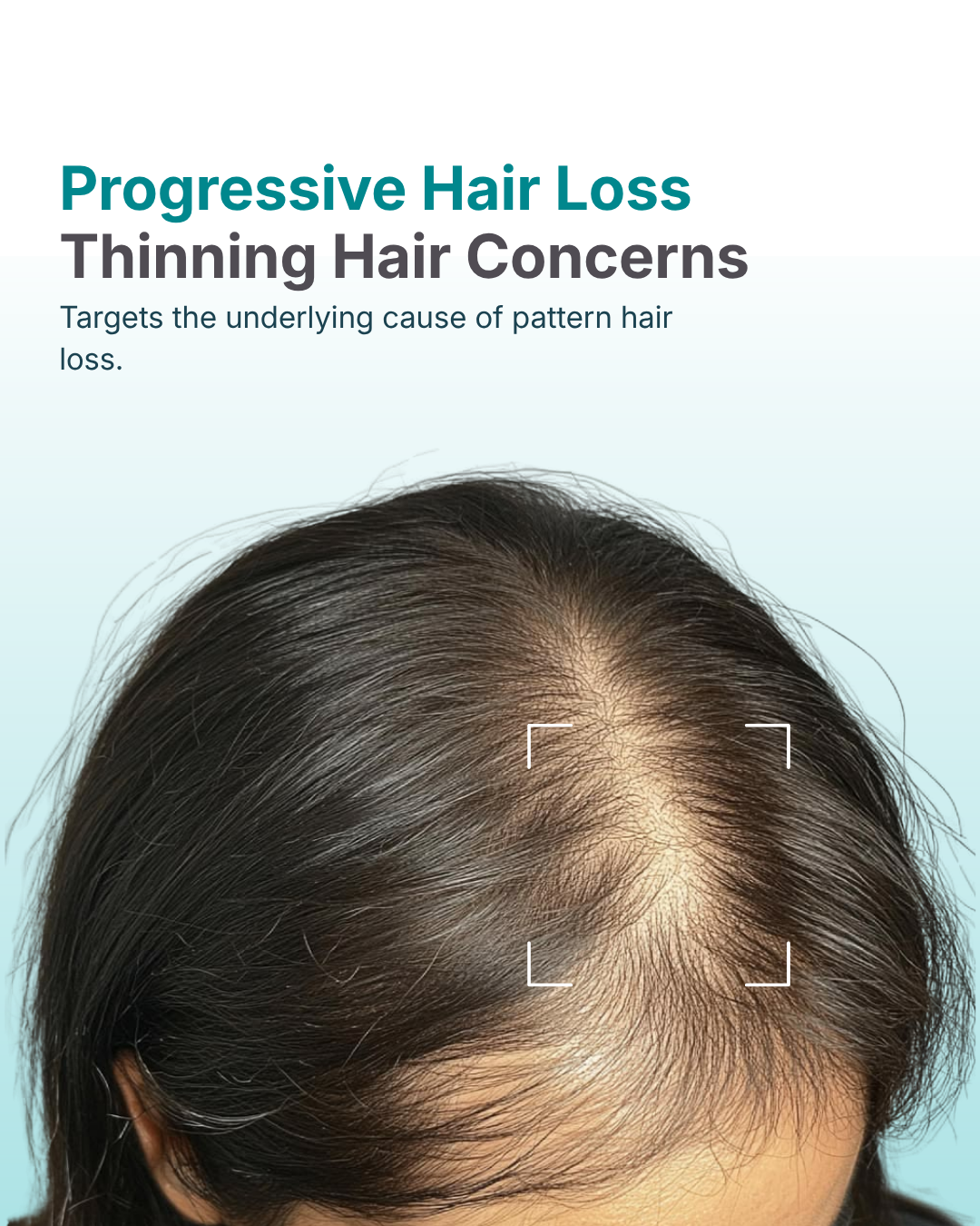 Oliva Finasteride 1mg tablets