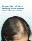 Oliva Finasteride 1mg tablets